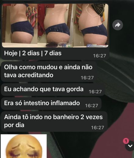 Depoimento 4 - IL